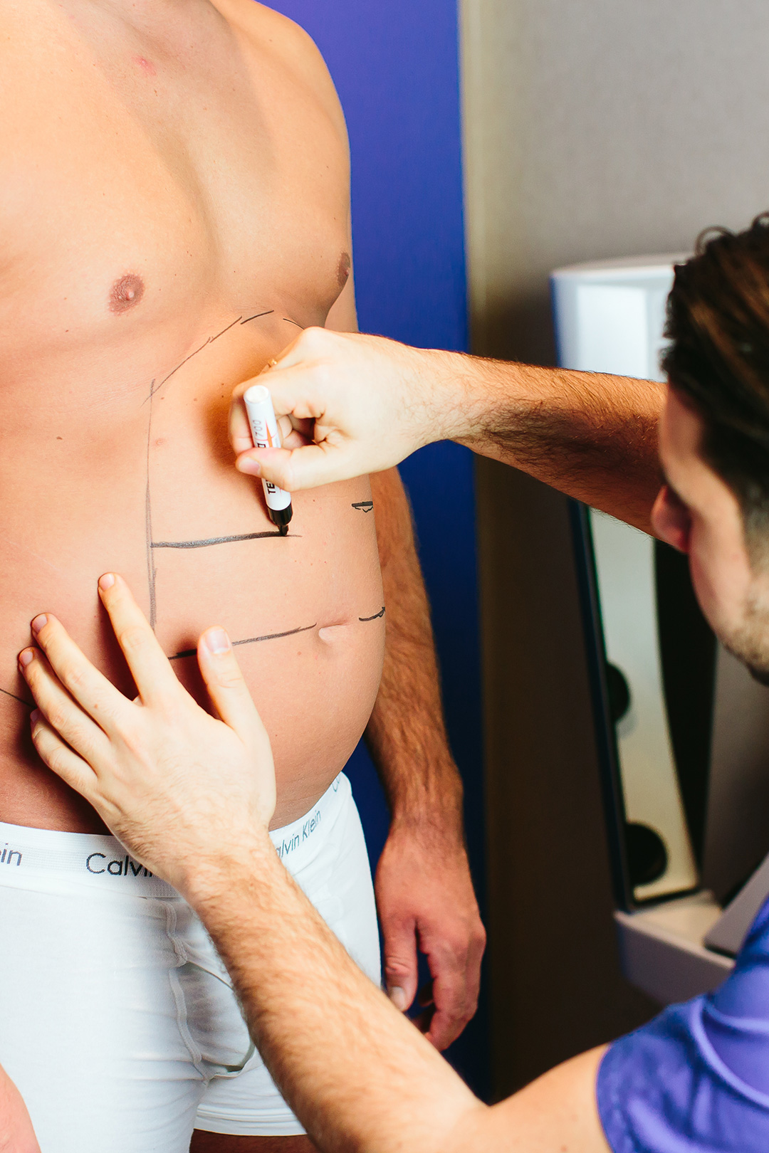 liposuction with Dr. Ali Saalabian at the Kuzbari Centre Vienna