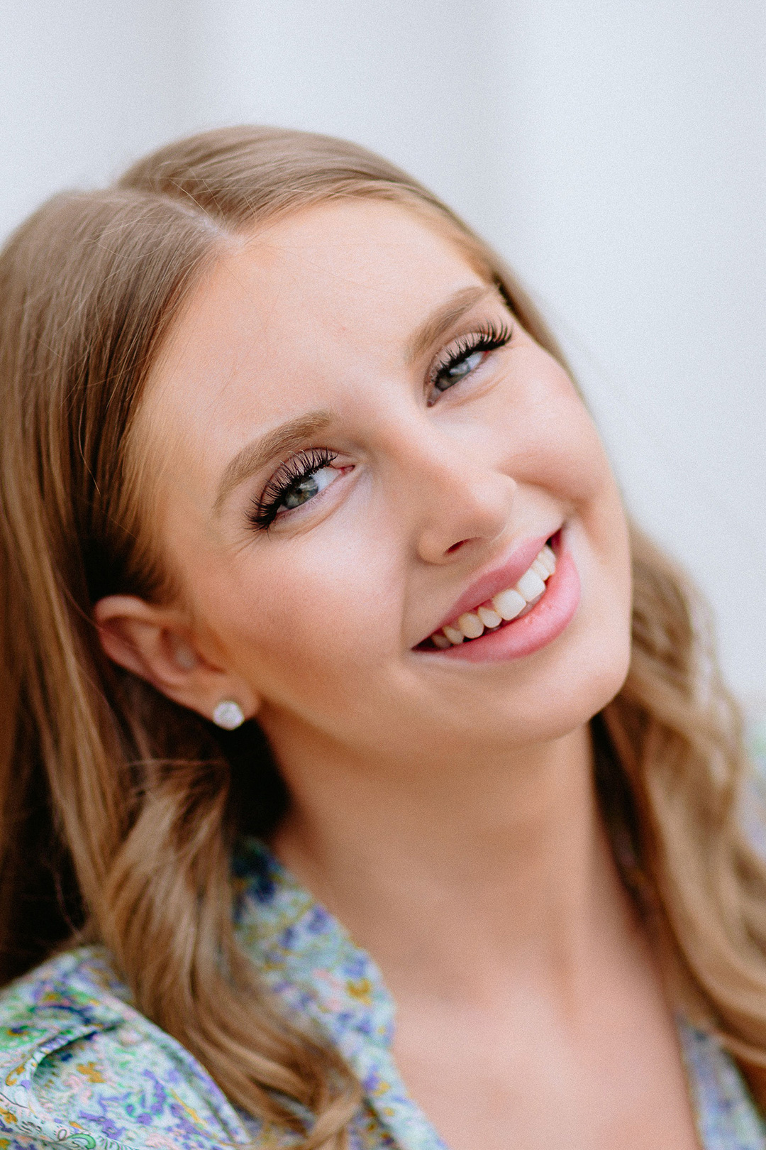 rhinoplasty with Dr. Christoph Grill at the Kuzbari Centre Vienna
