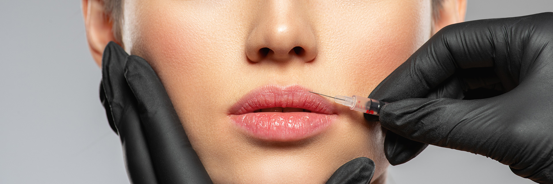 lip treatment Vienna